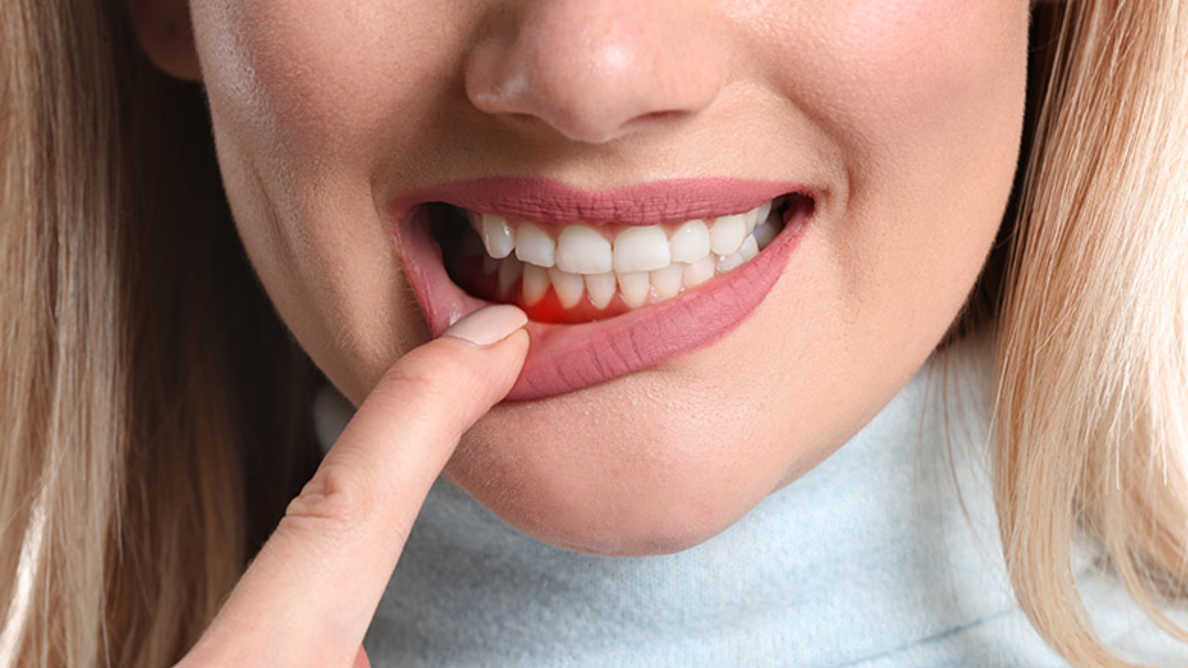 Periodontics Treatment